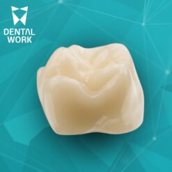 Restaurações em dissilicato de Lítio (Genérico Fresado) DW/INTRAOSS