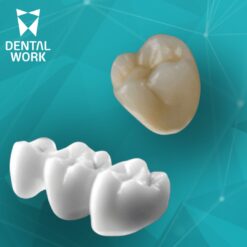 Restauração em Zircônia - DW/INTRAOSS
