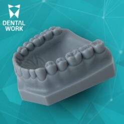 Modelo impresso 3D – Arcada total DW/INTRAOSS